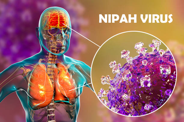 Understanding Nipah Virus: Origins, Symptoms, and Past Outbreaks